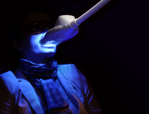 Does Laser Teeth Whitening Affect Fillings?