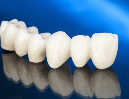Tooth Restoration